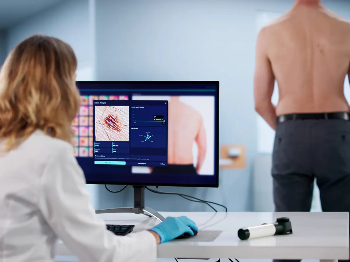 A clinician reviewing skin images on a screen during a skin check