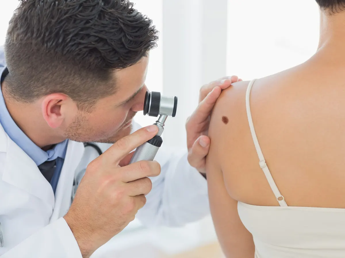 A doctor examining a mole on a woman's back with a dermatoscope