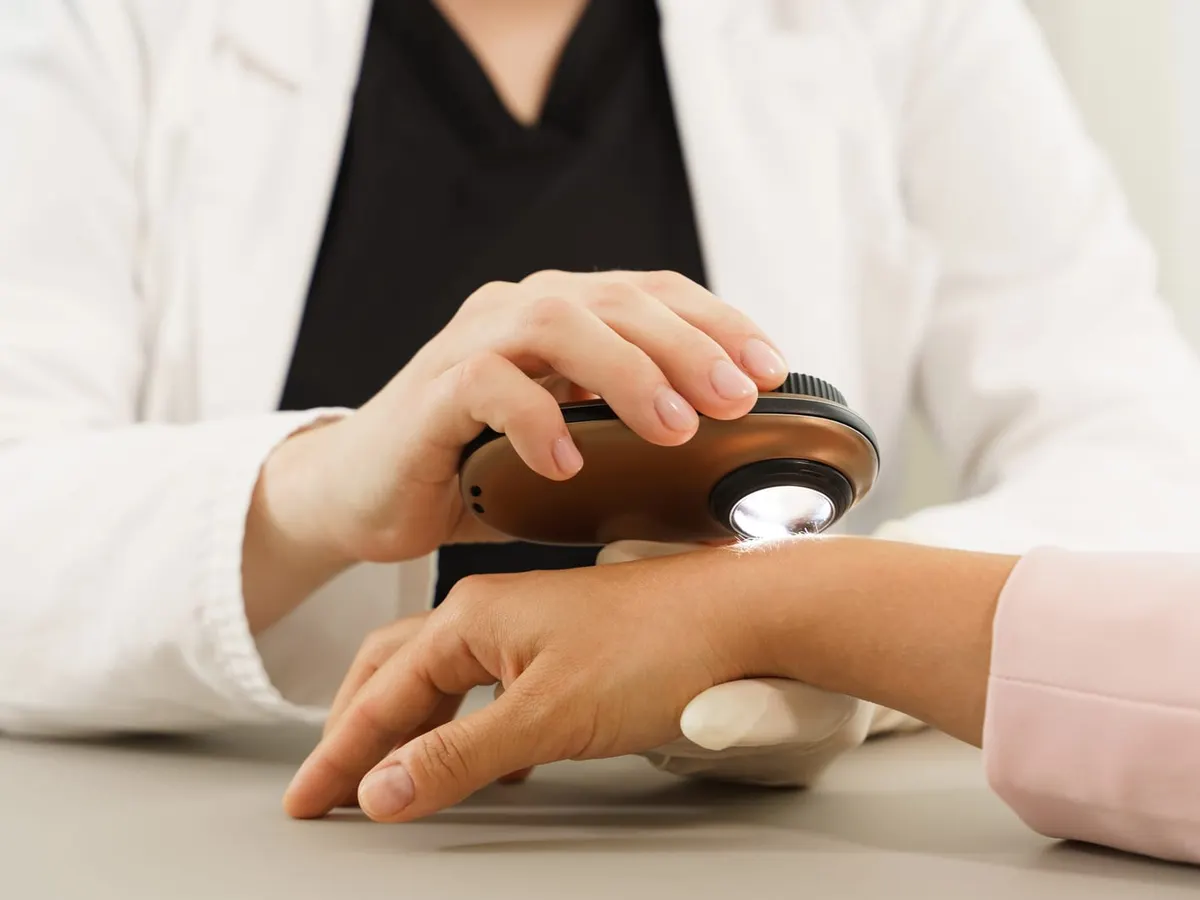 A clinician examines a spot on a patient’s hand with a dermatoscope