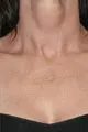 after Image of Photofacial San Antonio TX
