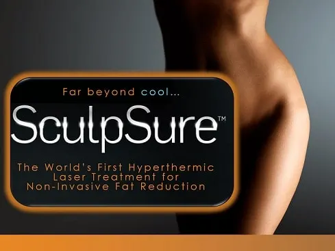 sculpsure