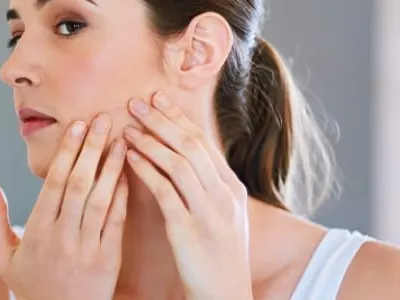 Accutane Acne Medication San Antonio TX