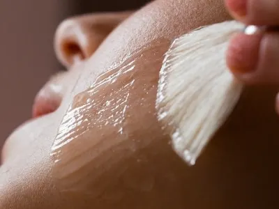 Chemical Peels San Antonio TX
