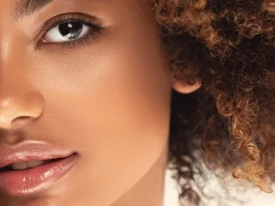 Photofacial IPL Treatment San Antonio TX