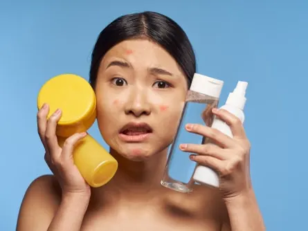 asian woman holding cream jars for acne problems
