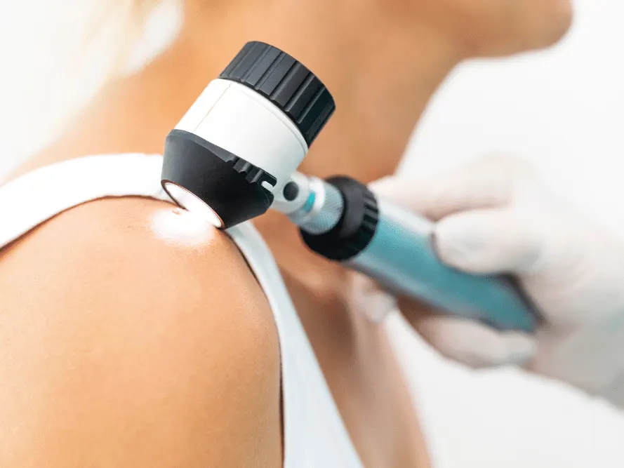 skin cancer screening