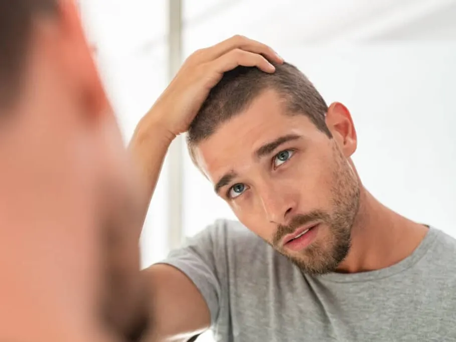 A man with scalp psoriasis in San Antonio looking in the mirror