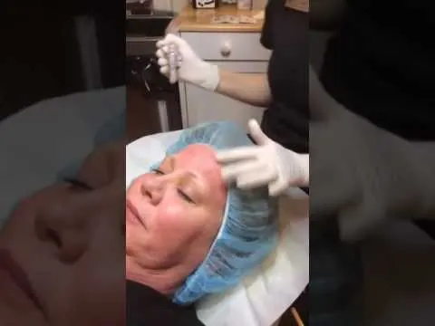 Micropen