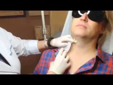 Kybella