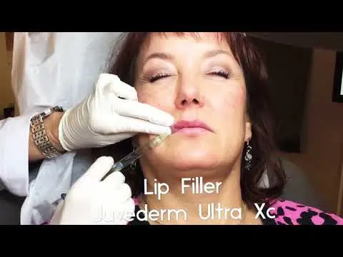 Filler Injection