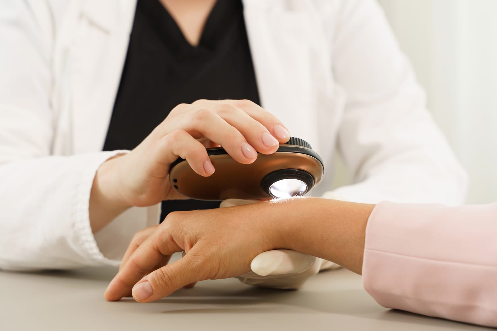A clinician examines a spot on a patient’s hand with a dermatoscope