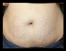 After Image: Fractora - front