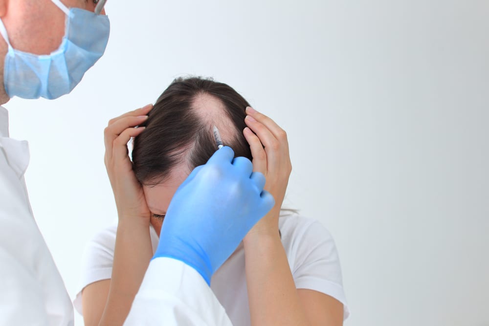 Patient gets PRP injections for alopecia areata in San Antonio