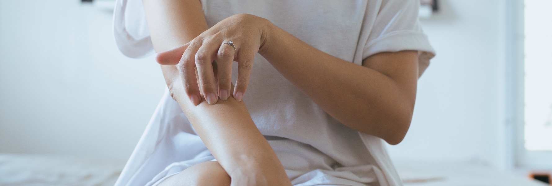 Psoriasis San Antonio TX
