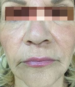 After Image: Liquid Lip - front