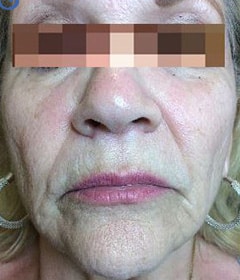 Before Image: Liquid Lip - front