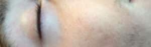 After Image: MicroPen