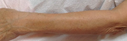 After Image: Photofacial - front