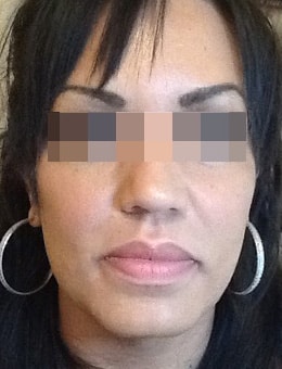 After Image: Voluma - front