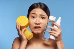 asian woman holding cream jars for acne problems