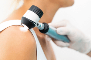 skin cancer screening