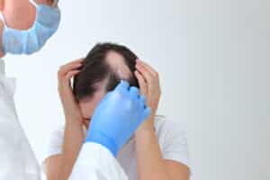 Patient gets PRP injections for alopecia areata in San Antonio