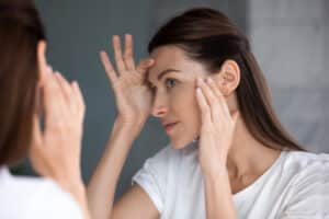A woman with melasma looking at her skin after getting a chemical peel