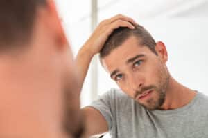 A man with scalp psoriasis in San Antonio looking in the mirror